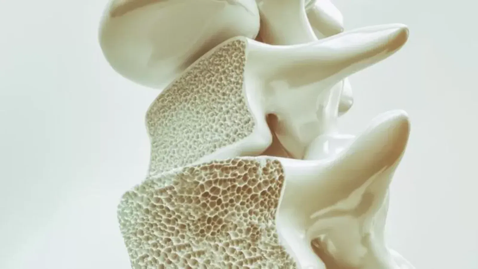 osteoporose